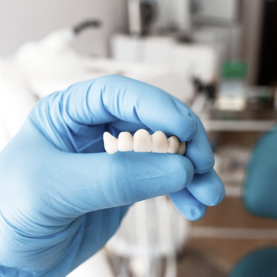 Close-up of dental bridge model
