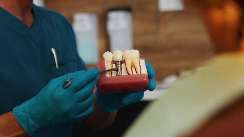 Dentist explaining dental implant treatment using tooth model during patient consultation